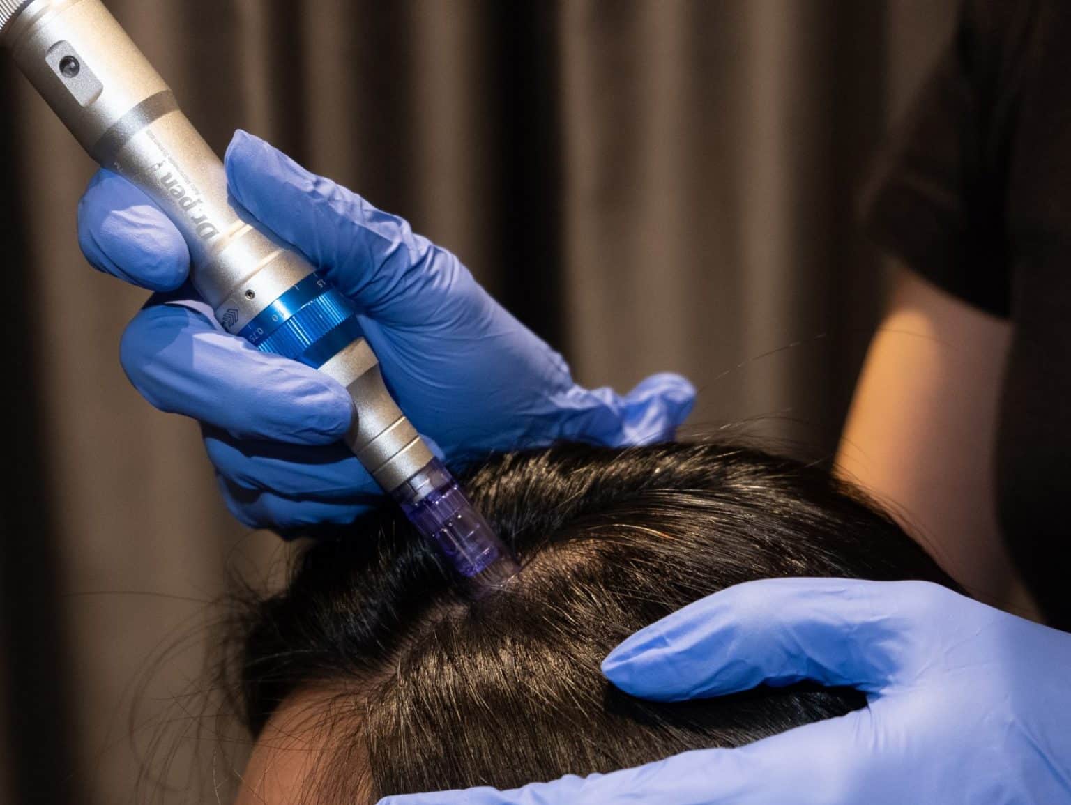 microneedlling