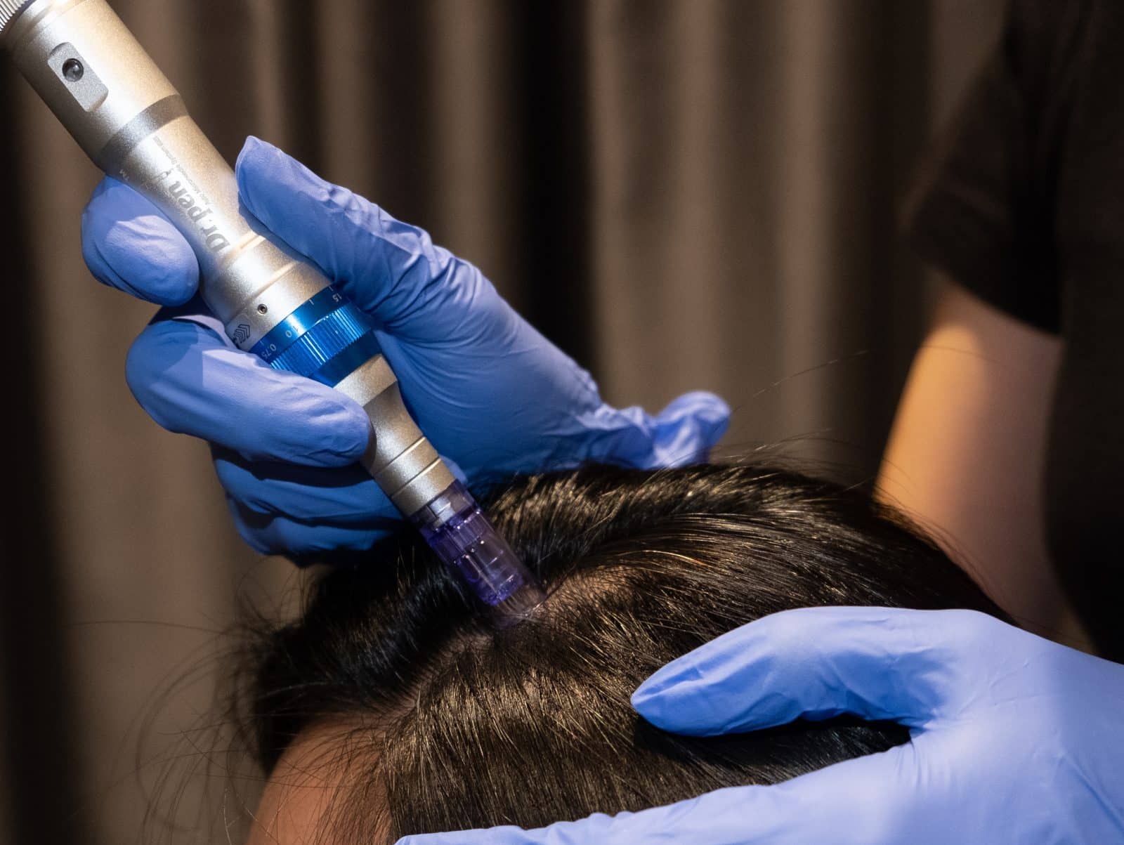 microneedlling