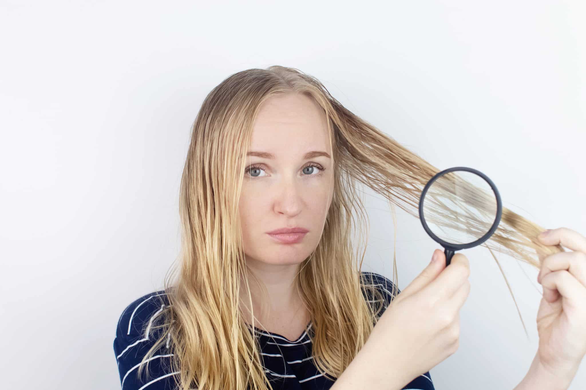  common causes of an oily scalp