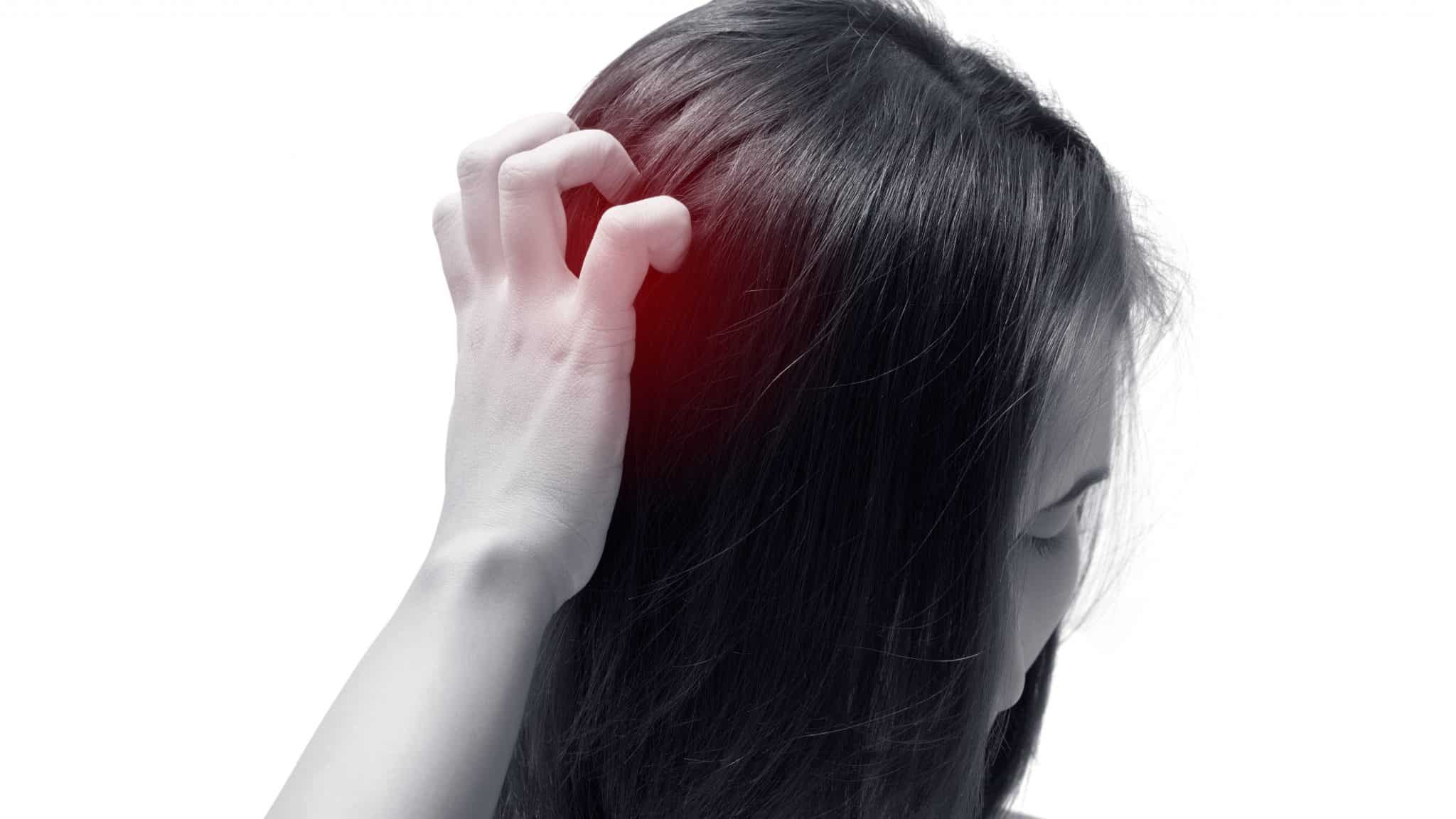 Does Itchy Scalp Cause Hair Loss