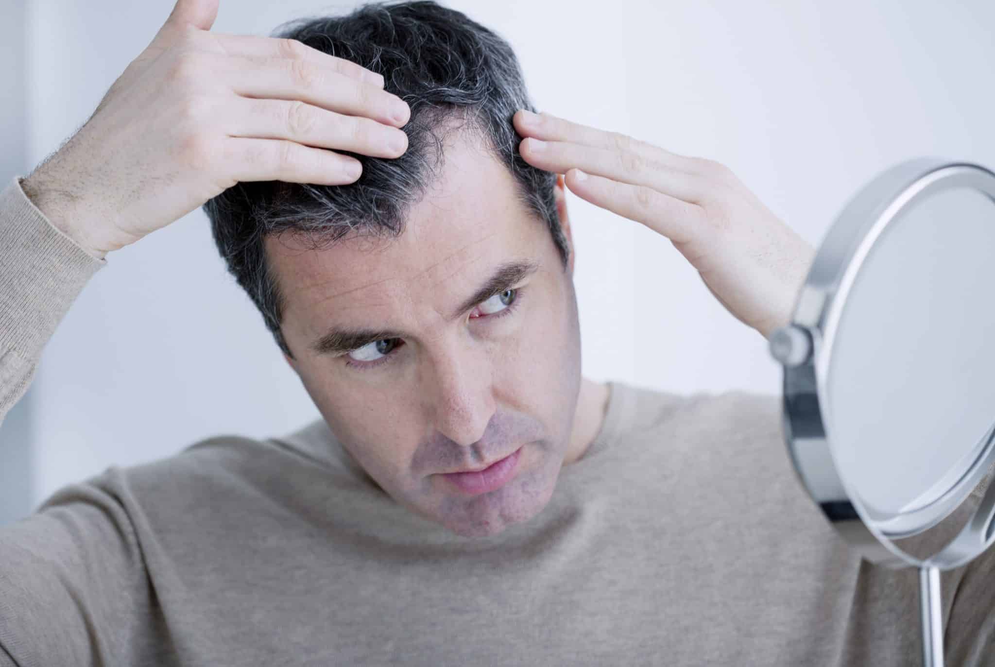 How does microneedling work for hair loss