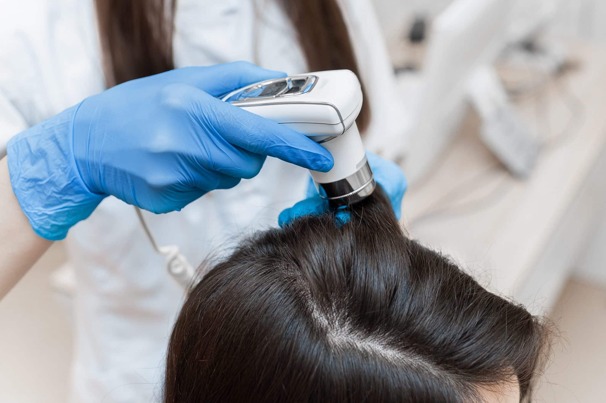 Treatments Are Available For Sensitive Scalp