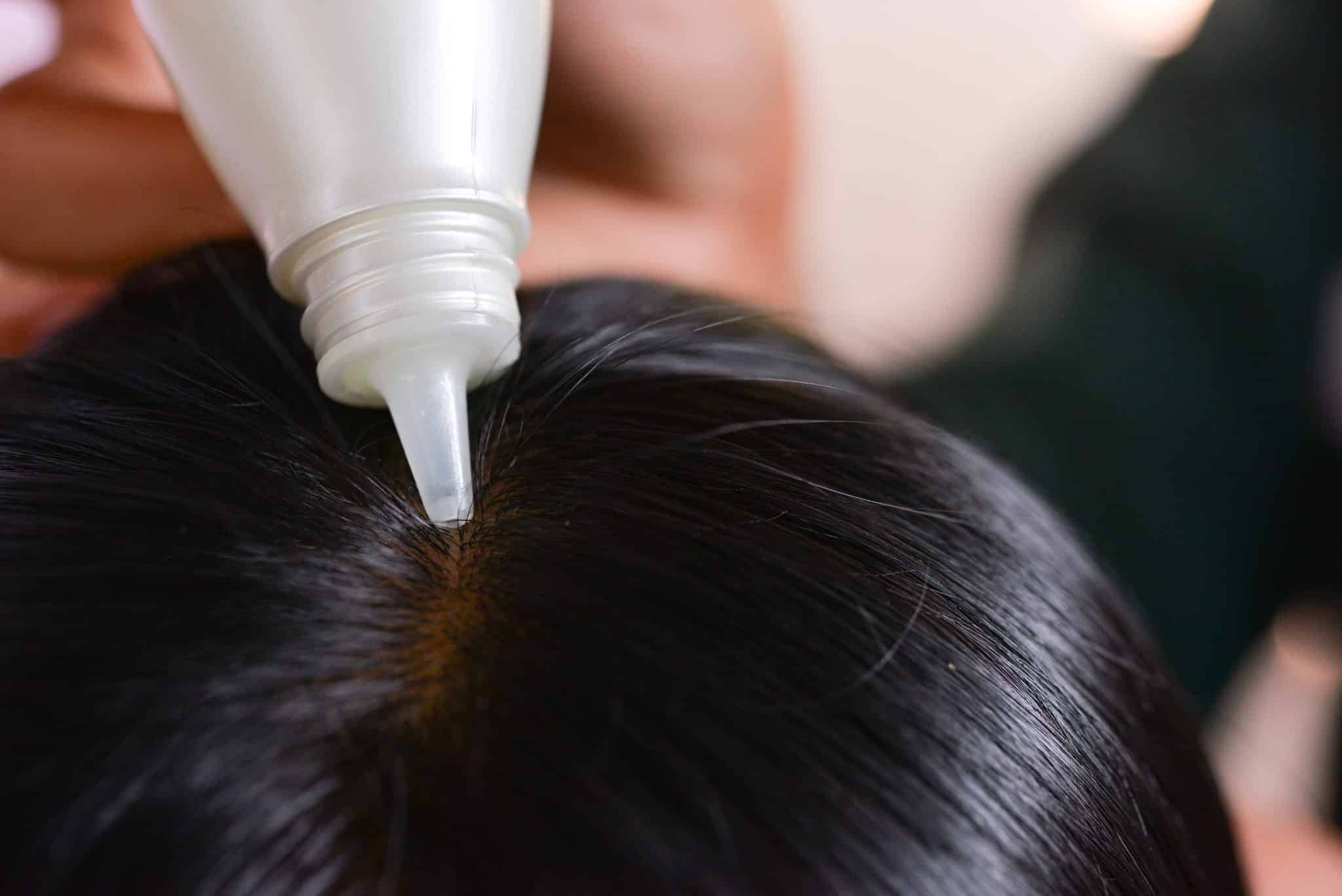 What are the types of scalp treatments available