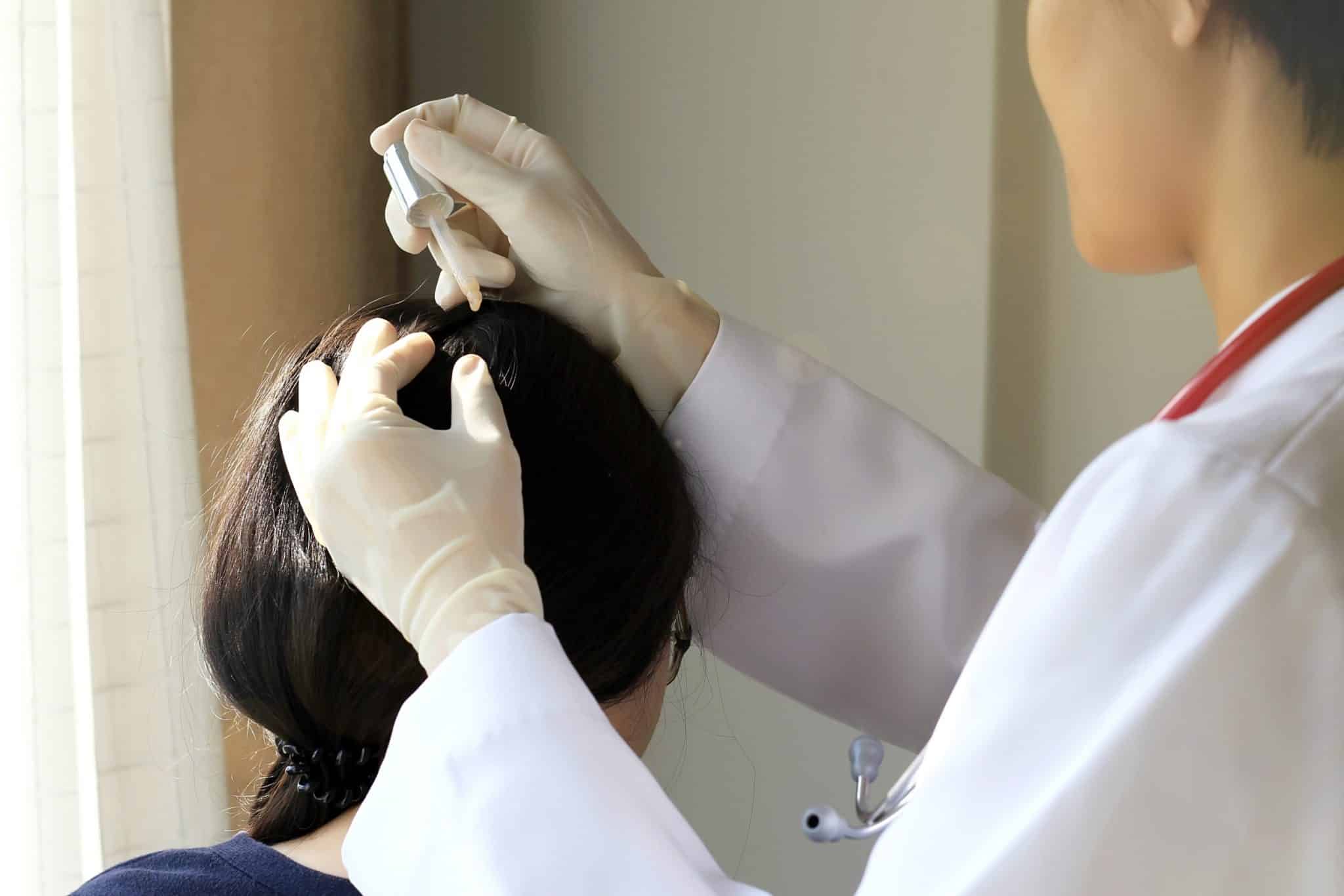 Who should get scalp treatments