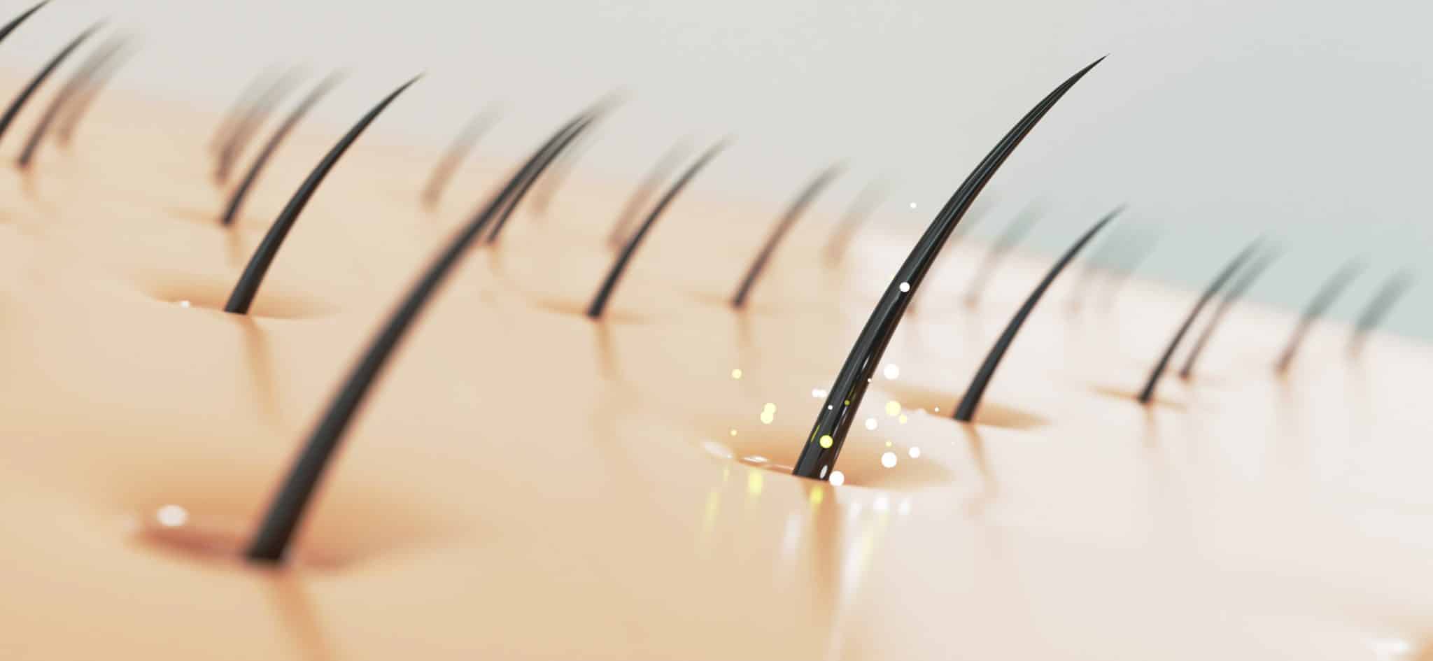 Causes of a dry and sensitive scalp