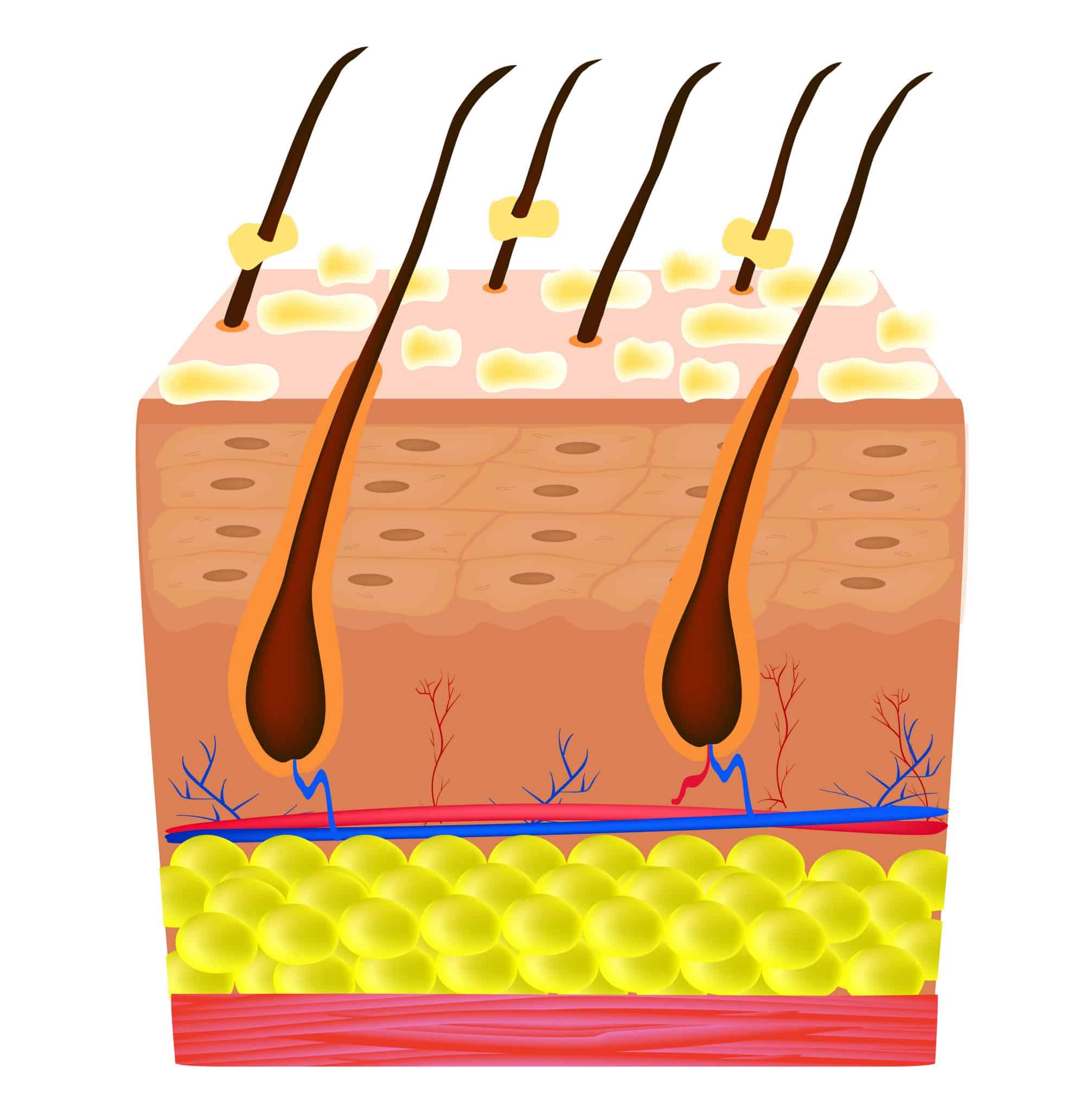 Seborrhea skin and hair. Dandruff seborrheic dermatitis. Dysfunction of the sebaceous glands. Inflammatory skin disease.