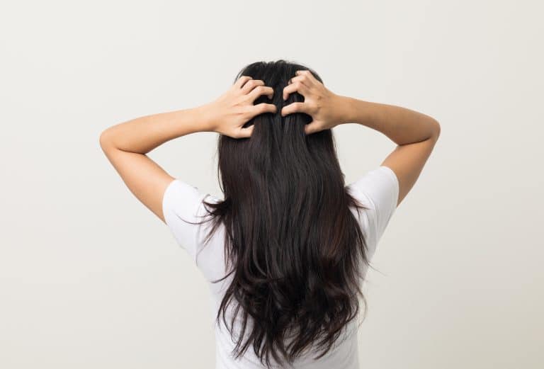 sensitive and itchy scalp