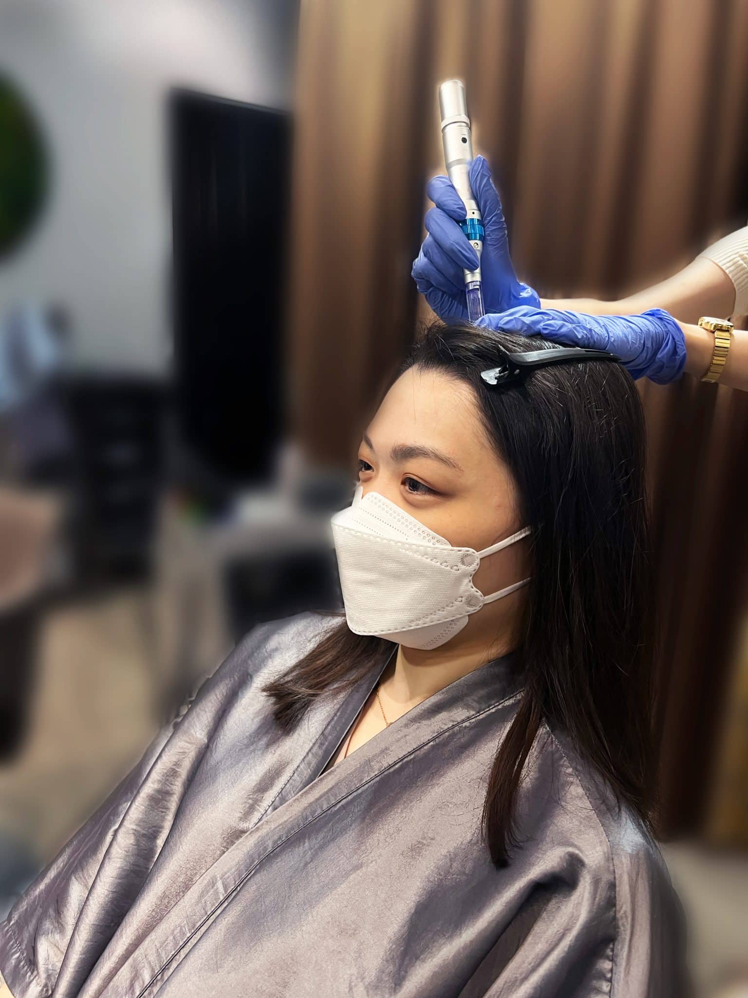 microneedling for hair loss procedure
