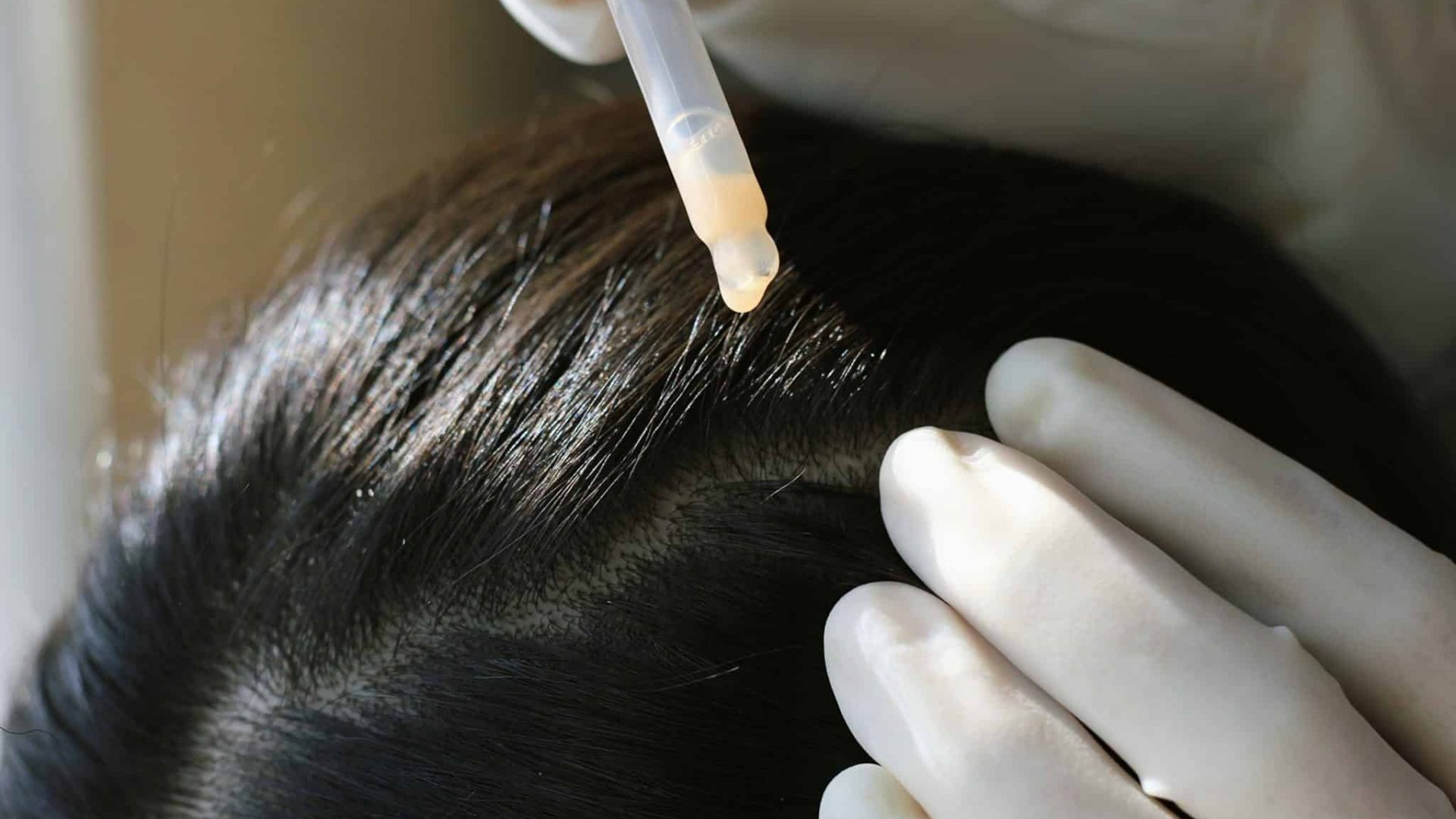 multivitamin serum for hair treatment